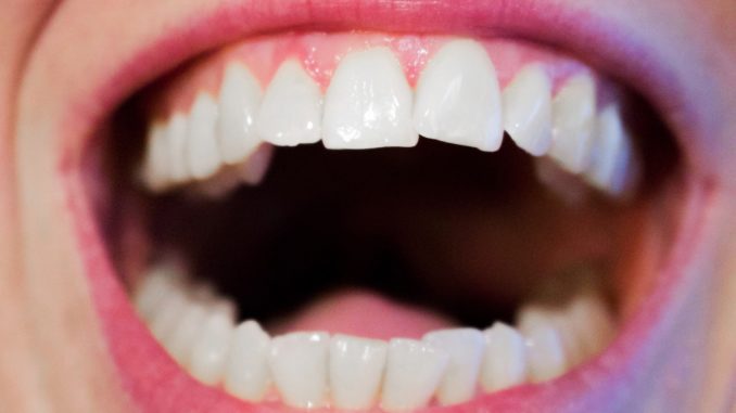 teeth-1652937_1920