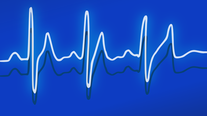 ekg-158177_960_720